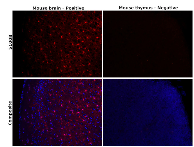 S100B Antibody in Immunohistochemistry (Paraffin) (IHC (P))