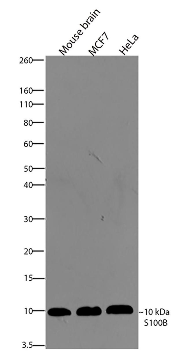 S100B Antibody in Western Blot (WB)