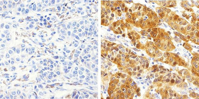 S100B Antibody in Immunohistochemistry (Paraffin) (IHC (P))