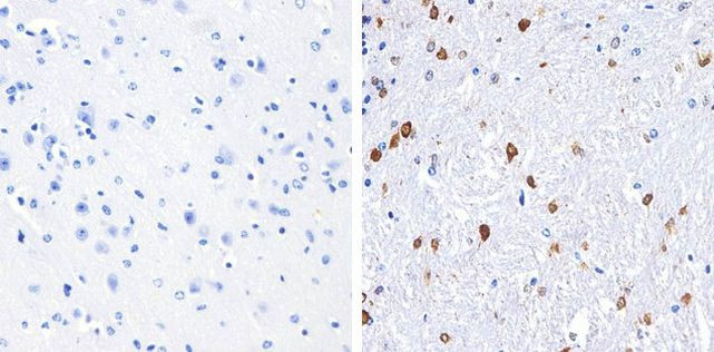 S100B Antibody in Immunohistochemistry (Paraffin) (IHC (P))