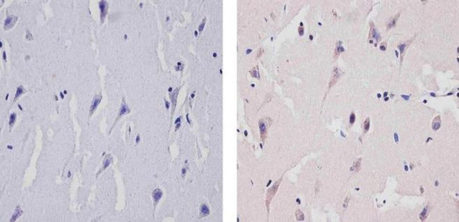 TNFR1 Antibody in Immunohistochemistry (Paraffin) (IHC (P))