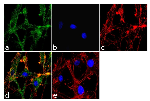 TPL2 Antibody in Immunocytochemistry (ICC/IF)