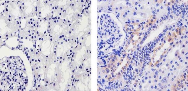 Fibrinogen Antibody in Immunohistochemistry (Paraffin) (IHC (P))