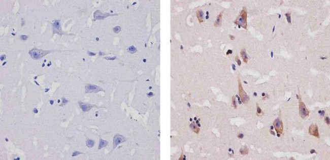 CCL4 Antibody in Immunohistochemistry (Paraffin) (IHC (P))