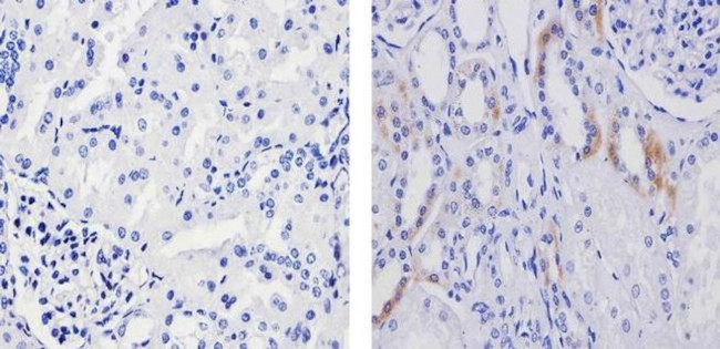 Phospho-TSC2 (Ser939) Antibody in Immunohistochemistry (Paraffin) (IHC (P))