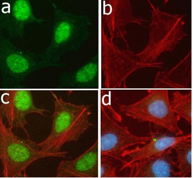 Phospho-TSC2 (Ser939) Antibody in Immunocytochemistry (ICC/IF)