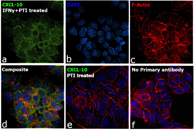 CXCL10 Antibody in Immunocytochemistry (ICC/IF)