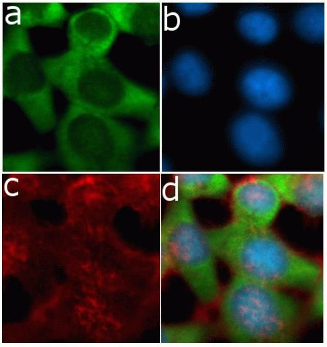 TIMP3 Antibody in Immunocytochemistry (ICC/IF)