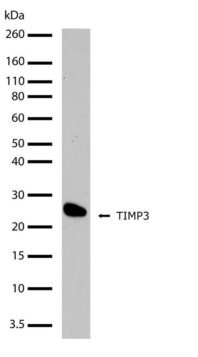 TIMP3 Antibody in Western Blot (WB)