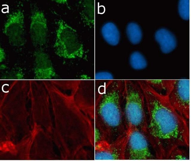 mTOR Antibody in Immunocytochemistry (ICC/IF)