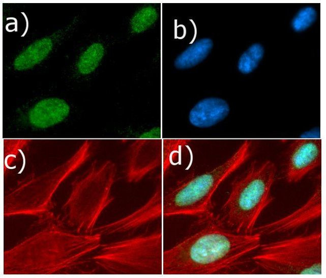 Cyclin D1 Antibody in Immunocytochemistry (ICC/IF)