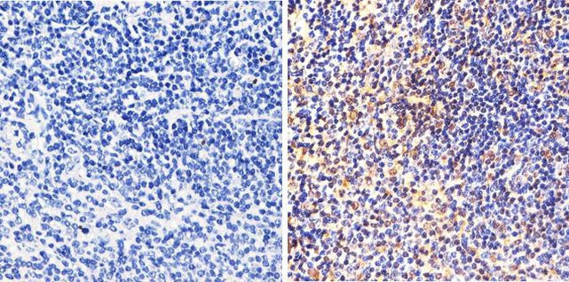 NFkB p50 Antibody in Immunohistochemistry (Paraffin) (IHC (P))