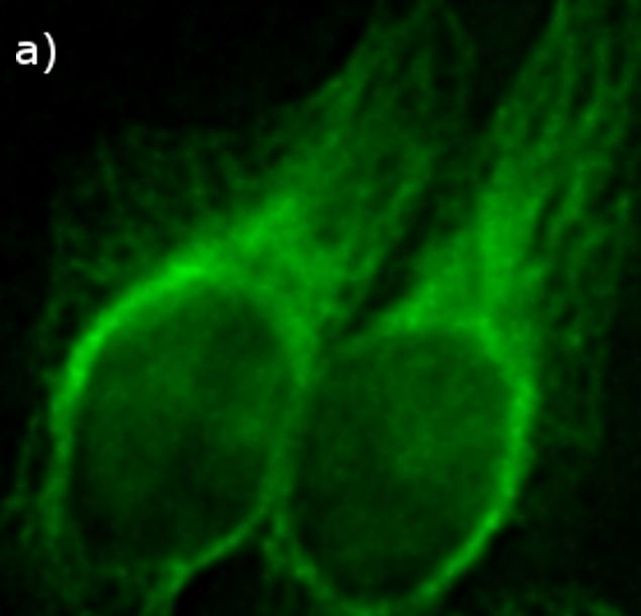 AFP Antibody in Immunocytochemistry (ICC/IF)