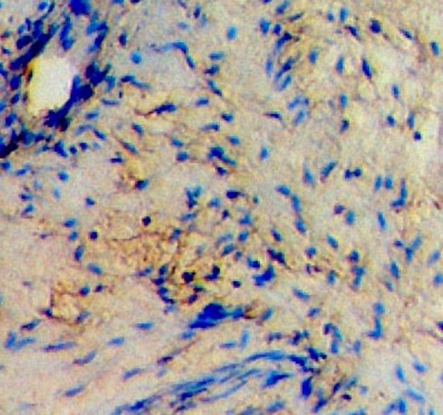 Alpha-Smooth Muscle Actin Antibody in Immunohistochemistry (IHC)