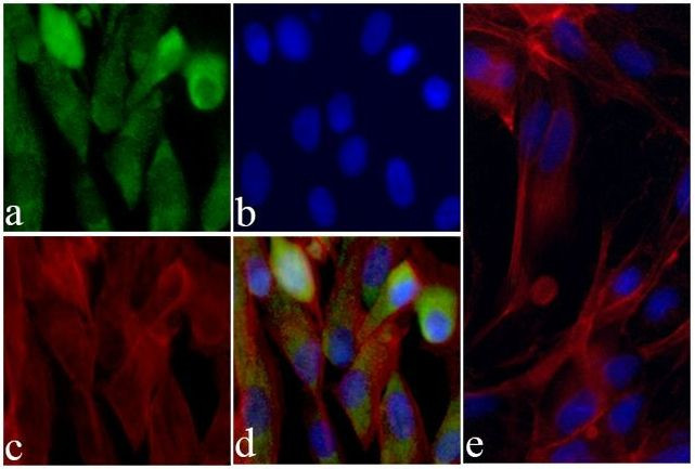 Alpha-Smooth Muscle Actin Antibody in Immunocytochemistry (ICC/IF)