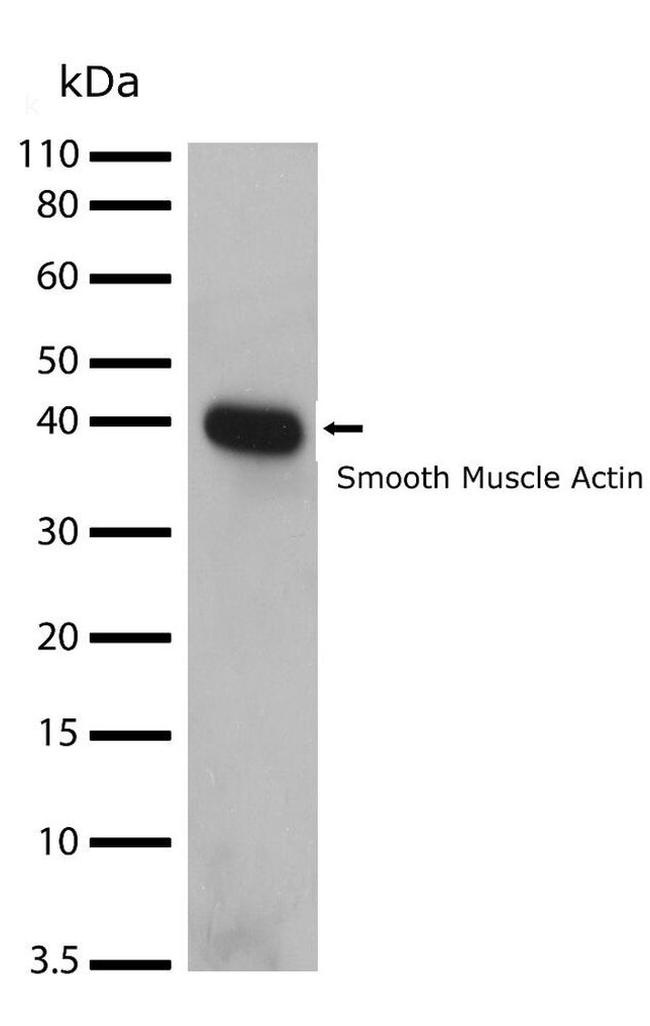 Alpha-Smooth Muscle Actin Antibody in Western Blot (WB)