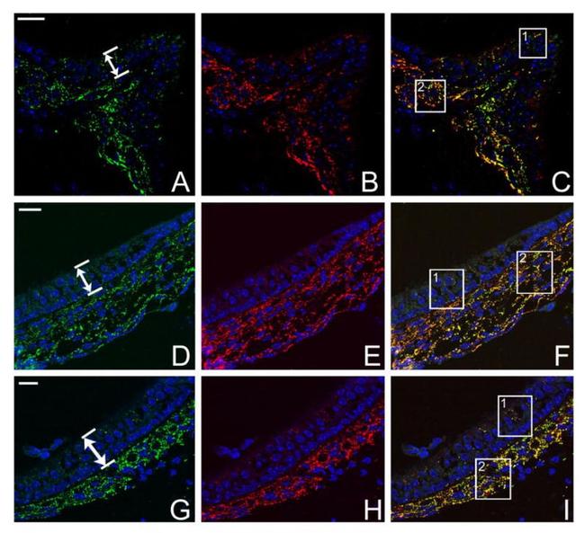 Connexin 26 Antibody in Immunohistochemistry (IHC)