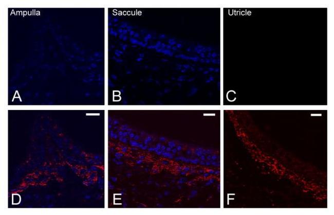 Connexin 26 Antibody in Immunohistochemistry (IHC)