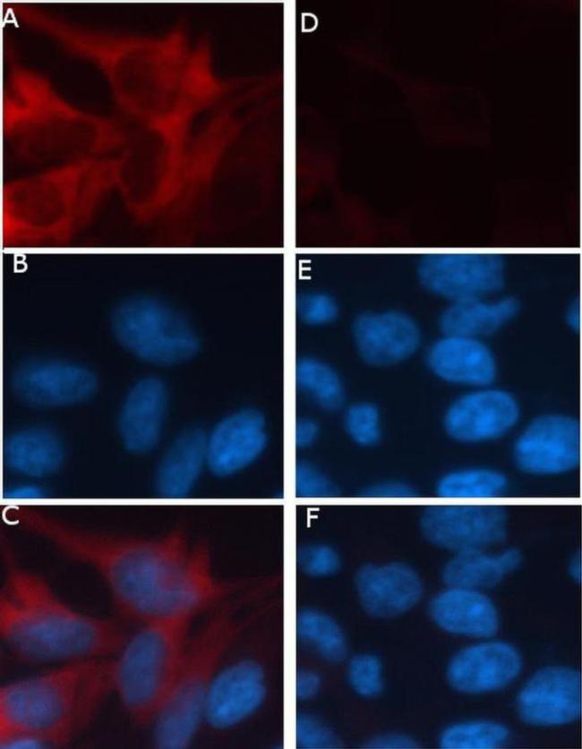 RFP Antibody