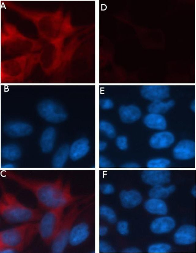 RFP Antibody in Immunocytochemistry (ICC/IF)