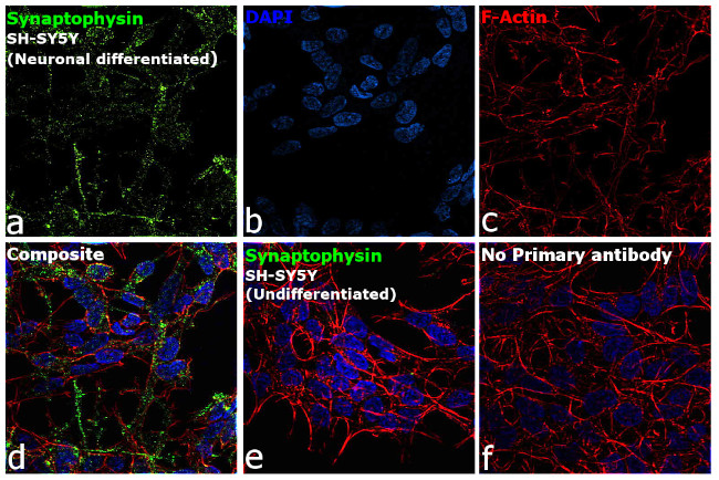 Synaptophysin Antibody