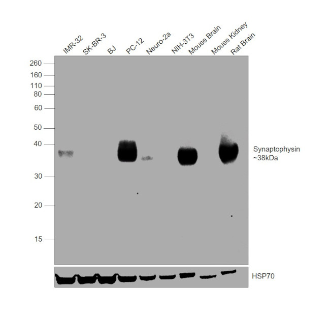 Synaptophysin Antibody