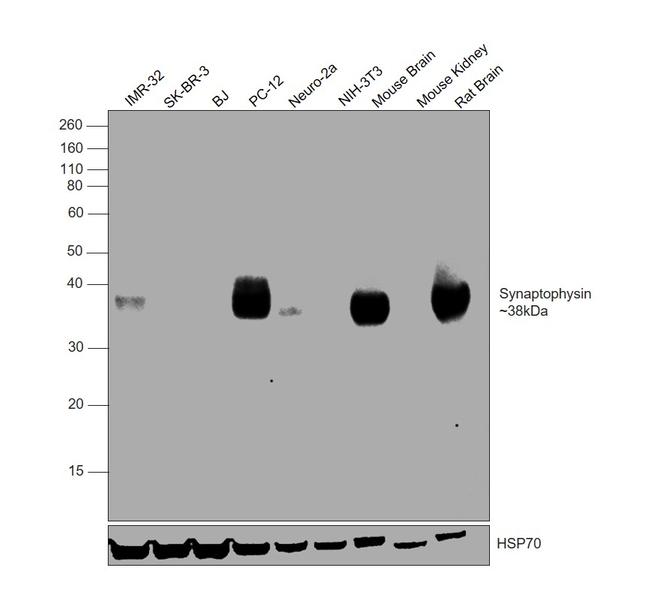 Synaptophysin Antibody in Western Blot (WB)