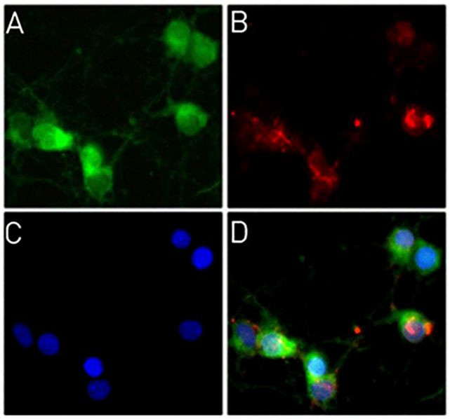 Synaptophysin Antibody in Immunocytochemistry (ICC/IF)