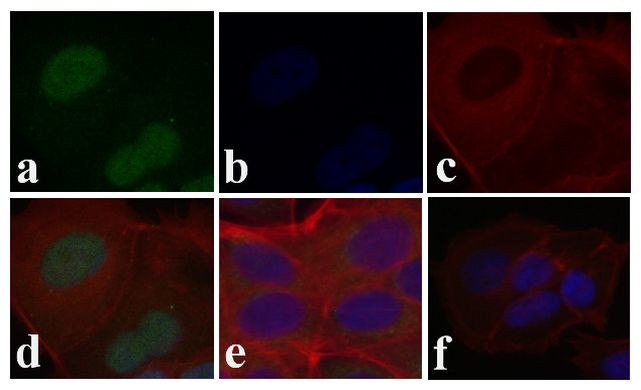 Phospho-SMAD2 (Ser465, Ser467) Antibody in Immunocytochemistry (ICC/IF)