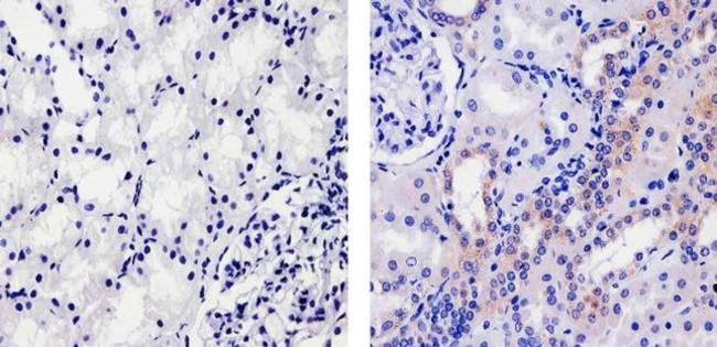 PSA Antibody in Immunohistochemistry (Paraffin) (IHC (P))