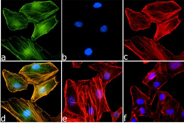 Phospho-IKK alpha/beta (Ser176, Ser180) Antibody in Immunocytochemistry (ICC/IF)