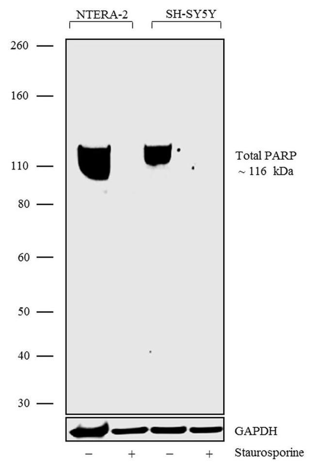 PARP1 Antibody in Western Blot (WB)