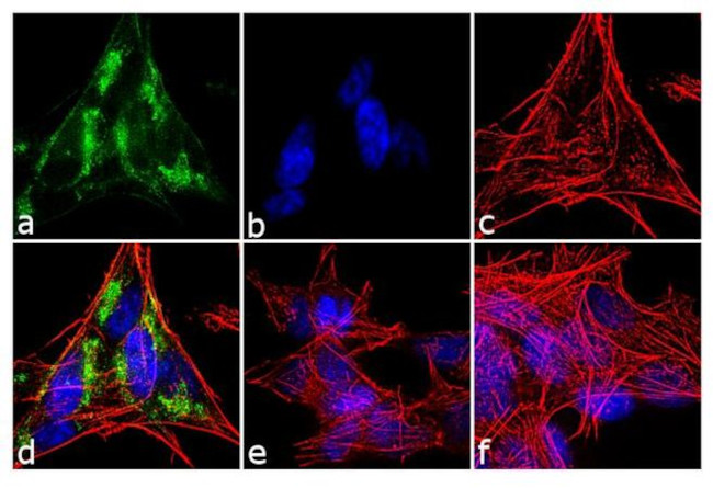 Huntingtin Antibody in Immunocytochemistry (ICC/IF)