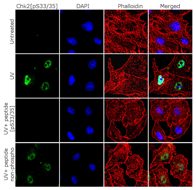 Phospho-CHK2 (Ser33, Ser35) Antibody in Immunocytochemistry (ICC/IF)