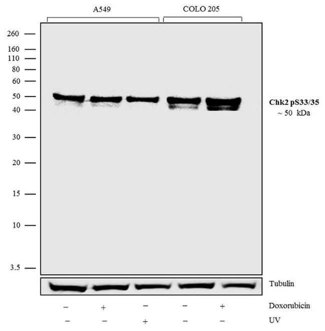 Phospho-CHK2 (Ser33, Ser35) Antibody in Western Blot (WB)