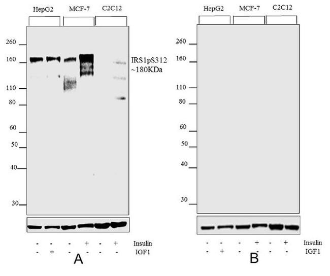 Phospho-IRS1 (Ser312) Antibody in Western Blot (WB)