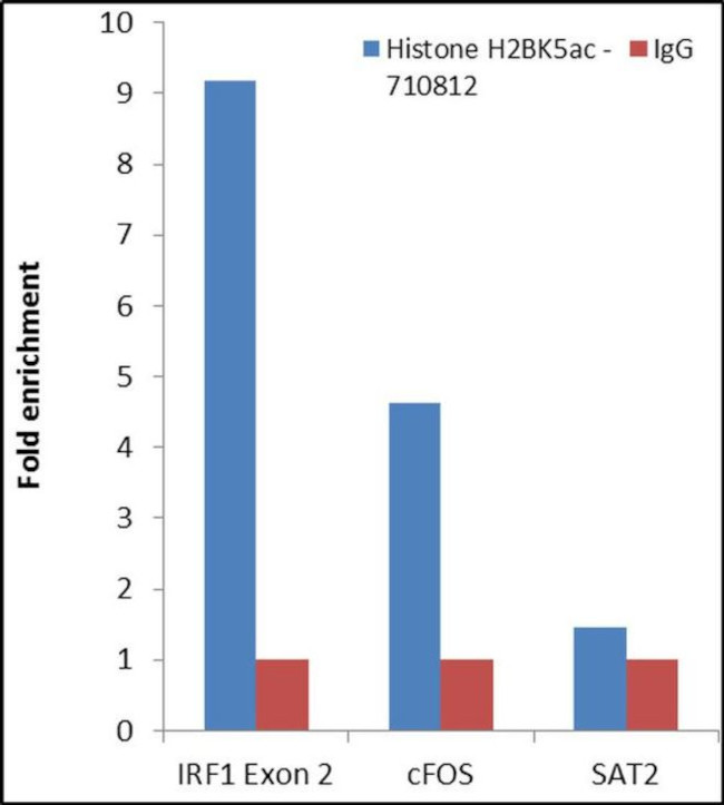 H2BK5ac Antibody