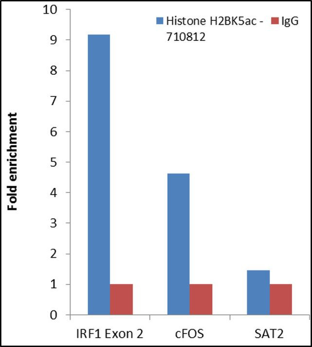 H2BK5ac Antibody in ChIP Assay (ChIP)