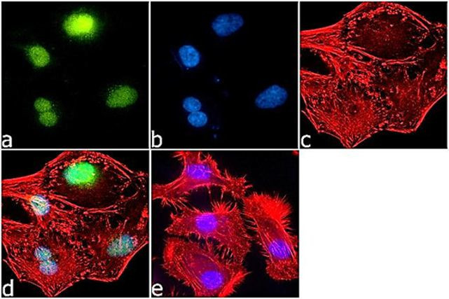 H2BK5ac Antibody in Immunocytochemistry (ICC/IF)