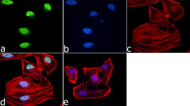 H3K9me3 Antibody in Immunocytochemistry (ICC/IF)