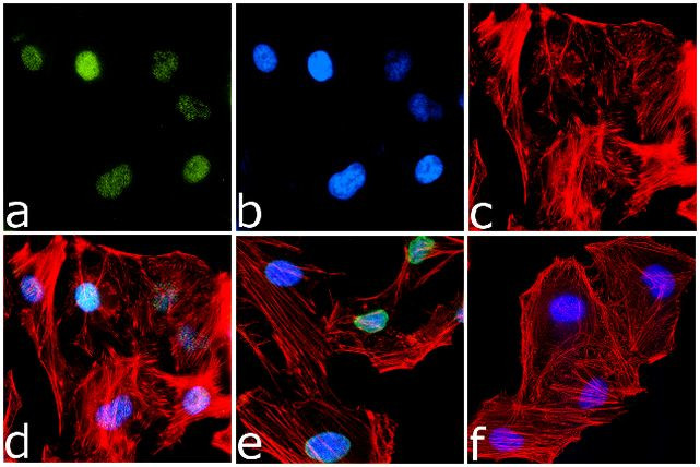 H4K12ac Antibody in Immunocytochemistry (ICC/IF)