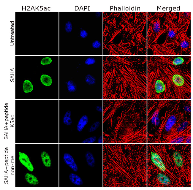 H2AK5ac Antibody in Immunocytochemistry (ICC/IF)