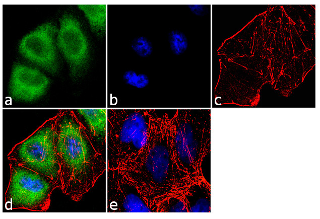 Kindlin Antibody in Immunocytochemistry (ICC/IF)