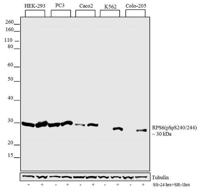 Phospho-S6 (Ser240, Ser244) Antibody