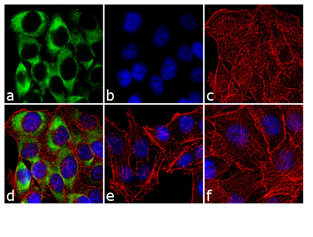 Phospho-S6 (Ser240, Ser244) Antibody in Immunocytochemistry (ICC/IF)