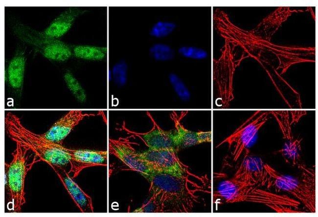 FOXO3A Antibody