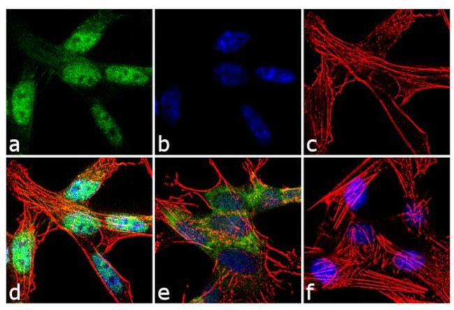 FOXO3A Antibody in Immunocytochemistry (ICC/IF)