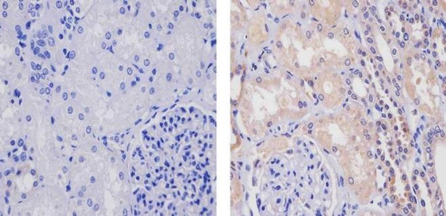 WNT2B Antibody in Immunohistochemistry (Paraffin) (IHC (P))