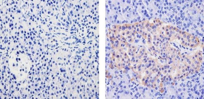 WNT2B Antibody in Immunohistochemistry (Paraffin) (IHC (P))