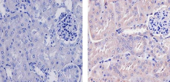 WNT2B Antibody in Immunohistochemistry (Paraffin) (IHC (P))